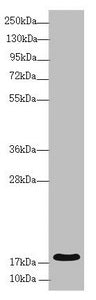 Western blot All lanes: RNF5 antibody at 3.94 ug/ml + Mouse gonadal tissue Secondary Goat polyclonal to rabbit IgG at 1/10000 dilution Predicted band size: 20 kDa Observed band size: 20 kDa