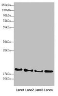 Western blot All lanes: RNF5 antibody at 3.08µg/ml Lane 1: A431 whole cell lysate Lane 2: Jurkat whole cell lysate Lane 3: Hela whole cell lysate Lane 4: HepG2 whole cell lysate Secondary Goat polyclonal to rabbit IgG at 1/10000 dilution Predicted band size: 20 kDa Observed band size: 20 kDa