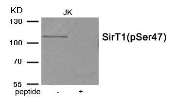 Western blot analysis of extracts from JK tissue using SirT1 (Phospho-Ser47) antibody.The lane on the right is treated with the antigen-specific peptide.