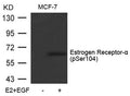 Western blot analysis of extracts from MCF-7 cells untreated or treated with E2 and EGF using Estrogen Receptor-a(Phospho-Ser104) Antibody