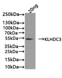 Western Blot
Positive WB detected in: recombinant protein
All lanes: KLHDC3 Antibody at 1:1000
Secondary
Goat polyclonal to rabbit IgG at 1/50000 dilution
Predicted band size: 52 kDa
Observed band size: 52 kDa