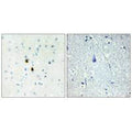Immunohistochemistry analysis of paraffin-embedded human brain tissue, using TPD52 antibody.