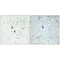 Immunohistochemistry analysis of paraffin-embedded human brain tissue, using TPD52 antibody.