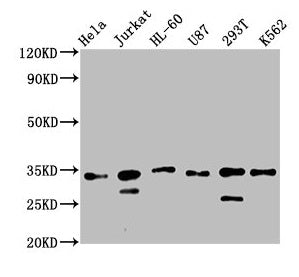 Western Blot
Positive WB detected in: Hela whole cell lysate, Jurkat whole cell lysate, HL60 whole cell lysate, U87 whole cell lysate, 293T whole cell lysate, K562 whole cell lysate
All lanes: TSNAX antibody at 2.5µg/ml
Secondary
Goat polyclonal to rabbit IgG at 1/50000 dilution
Predicted band size: 34 kDa
Observed band size: 34 kDa