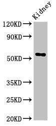 Western Blot
Positive WB detected in: Rat kideny tissue
All lanes: Fuca1 antibody at 3.4ug/ml
Secondary
Goat polyclonal to rabbit IgG at 1/50000 dilution
Predicted band size: 53 kDa
Observed band size: 53 kDa