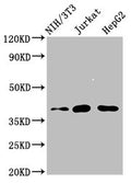 Western Blot
Positive WB detected in: NIH/3T3 whole cell lysate, Jurkat whole cell lysate, HepG2 whole cell lysate
All lanes: RNF2 antibody at 4µg/ml
Secondary
Goat polyclonal to rabbit IgG at 1/50000 dilution
Predicted band size: 38, 30 kDa
Observed band size: 38 kDa