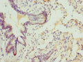 Immunohistochemistry of paraffin-embedded human lung tissue using CSB-PA859942ESR1HU at dilution of 1:100