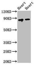 Western Blot
Positive WB detected in: Rat heart tissue, Mouse heart tissue
All lanes: ACO2 antibody at 2.5ug/ml
Secondary
Goat polyclonal to rabbit IgG at 1/50000 dilution
Predicted band size: 86 kDa
Observed band size: 86 kDa