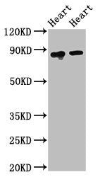 Western Blot
Positive WB detected in: Rat heart tissue, Mouse heart tissue
All lanes: ACO2 antibody at 2.5ug/ml
Secondary
Goat polyclonal to rabbit IgG at 1/50000 dilution
Predicted band size: 86 kDa
Observed band size: 86 kDa