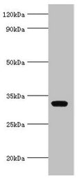 Western blot
All lanes: AGPAT1 antibody at 6µg/ml + K562 whole cell lysate
Secondary
Goat polyclonal to rabbit IgG at 1/10000 dilution
Predicted band size: 32 kDa
Observed band size: 32 kDa