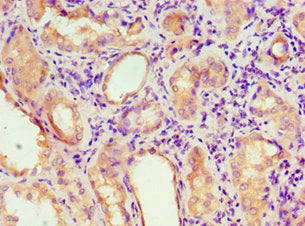 Immunohistochemistry of paraffin-embedded human kidney tissue using CSB-PA859948ESR2HU at dilution of 1:100