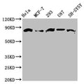 Western Blot
Positive WB detected in: Hela whole cell lysate, MCF-7 whole cell lysate, 293 whole cell lysate, U87 whole cell lysate, SH-SY5Y whole cell lysate 
All lanes: BARD1 antibody at 3.6ug/ml
Secondary
Goat polyclonal to rabbit IgG at 1/50000 dilution
Predicted band size: 87, 85, 76, 15 kDa
Observed band size: 87 kDa