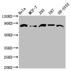 Western Blot
Positive WB detected in: Hela whole cell lysate, MCF-7 whole cell lysate, 293 whole cell lysate, U87 whole cell lysate, SH-SY5Y whole cell lysate 
All lanes: BARD1 antibody at 3.6ug/ml
Secondary
Goat polyclonal to rabbit IgG at 1/50000 dilution
Predicted band size: 87, 85, 76, 15 kDa
Observed band size: 87 kDa