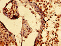 Immunohistochemistry of paraffin-embedded human testis tissue using CSB-PA860780LA01HU at dilution of 1:100