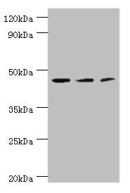 Western blot All lanes: ACY1 antibody at 4µg/ml Lane 1: K562 whole cell lysate Lane 2: HepG2 whole cell lysate Lane 3: Mouse kidney tissue Secondary Goat polyclonal to rabbit IgG at 1/10000 dilution Predicted band size: 46, 38, 39, 43 kDa Observed band size: 46 kDa
