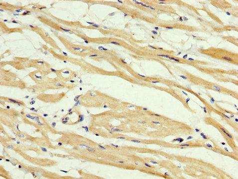IHC image of CSB-PA861144LA01HU diluted at 1:400 and staining in paraffin-embedded human heart tissue performed on a Leica BondTM system. After dewaxing and hydration, antigen retrieval was mediated by high pressure in a citrate buffer (pH 6.0). Section was blocked with 10% normal goat serum 30min at RT. Then primary antibody (1% BSA) was incubated at 4&deg;C overnight. The primary is detected by a biotinylated secondary antibody and visualized using an HRP conjugated SP system.