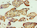Immunohistochemistry of paraffin-embedded human placenta tissue using CSB-PA861152ESR1HU at dilution of 1:100