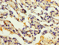 Immunohistochemistry of paraffin-embedded human lung tissue using CSB-PA861182ESR1HU at dilution of 1:100