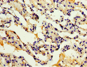 Immunohistochemistry of paraffin-embedded human lung tissue using CSB-PA861182ESR1HU at dilution of 1:100