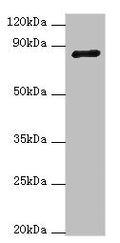 Western blot All lanes: ADAM33 antibody at 4ug/ml + NIH/3T3 whole cell lysate Secondary Goat polyclonal to rabbit IgG at 1/10000 dilution Predicted band size: 88, 85, 33 kDa Observed band size: 88 kDa