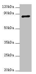 Western blot All lanes: ADAM33 antibody at 4ug/ml + NIH/3T3 whole cell lysate Secondary Goat polyclonal to rabbit IgG at 1/10000 dilution Predicted band size: 88, 85, 33 kDa Observed band size: 88 kDa