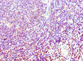 Immunohistochemistry of paraffin-embedded human tonsil tissue using CSB-PA861988ESR2HU at dilution of 1:100