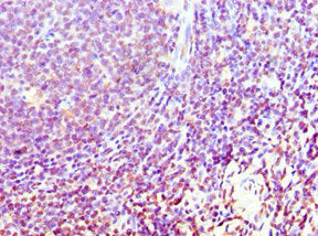 Immunohistochemistry of paraffin-embedded human tonsil tissue using CSB-PA861988ESR2HU at dilution of 1:100