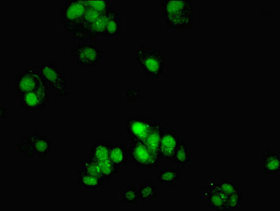Immunofluorescent analysis of MCF-7 cells using CSB-PA861988LA01HU at dilution of 1:100 and Alexa Fluor 488-congugated AffiniPure Goat Anti-Rabbit IgG(H+L)