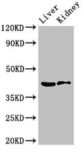 Western Blot
Positive WB detected in: Mouse liver tissue, Mouse kidney tissue
All lanes: HSD3B7 antibody at 3.5ug/ml
Secondary
Goat polyclonal to rabbit IgG at 1/50000 dilution
Predicted band size: 42, 22 kDa
Observed band size: 42 kDa