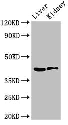 Western Blot
Positive WB detected in: Mouse liver tissue, Mouse kidney tissue
All lanes: HSD3B7 antibody at 3.5ug/ml
Secondary
Goat polyclonal to rabbit IgG at 1/50000 dilution
Predicted band size: 42, 22 kDa
Observed band size: 42 kDa