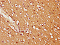 IHC image of CSB-PA862044LA01HU diluted at 1:200 and staining in paraffin-embedded human brain tissue performed on a Leica BondTM system. After dewaxing and hydration, antigen retrieval was mediated by high pressure in a citrate buffer (pH 6.0). Section was blocked with 10% normal goat serum 30min at RT. Then primary antibody (1% BSA) was incubated at 4°C overnight. The primary is detected by a biotinylated secondary antibody and visualized using an HRP conjugated SP system.