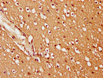 IHC image of CSB-PA862044LA01HU diluted at 1:200 and staining in paraffin-embedded human brain tissue performed on a Leica BondTM system. After dewaxing and hydration, antigen retrieval was mediated by high pressure in a citrate buffer (pH 6.0). Section was blocked with 10% normal goat serum 30min at RT. Then primary antibody (1% BSA) was incubated at 4°C overnight. The primary is detected by a biotinylated secondary antibody and visualized using an HRP conjugated SP system.