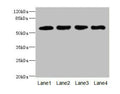Western blot All lanes: IL21R antibody at 2.18ug/ml Lane 1: A549 whole cell lysate Lane 2: Raji whole cell lysate Lane 3: Colo320 whole cell lysate Lane 4: K562 whole cell lysate Secondary Goat polyclonal to rabbit IgG at 1/10000 dilution Predicted band size: 59 kDa Observed band size: 59 kDa