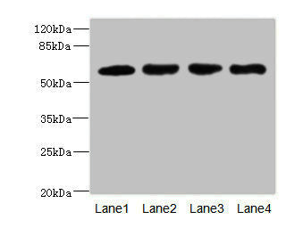 Western blot All lanes: IL21R antibody at 2.18ug/ml Lane 1: A549 whole cell lysate Lane 2: Raji whole cell lysate Lane 3: Colo320 whole cell lysate Lane 4: K562 whole cell lysate Secondary Goat polyclonal to rabbit IgG at 1/10000 dilution Predicted band size: 59 kDa Observed band size: 59 kDa