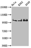 Western Blot
Positive WB detected in: Hela whole cell lysate, K562 whole cell lysate, A549 whole cell lysate
All lanes: XAB2 antibody at 3µg/ml
Secondary
Goat polyclonal to rabbit IgG at 1/50000 dilution
Predicted band size: 101 kDa
Observed band size: 101 kDa