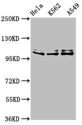 Western Blot
Positive WB detected in: Hela whole cell lysate, K562 whole cell lysate, A549 whole cell lysate
All lanes: XAB2 antibody at 3µg/ml
Secondary
Goat polyclonal to rabbit IgG at 1/50000 dilution
Predicted band size: 101 kDa
Observed band size: 101 kDa