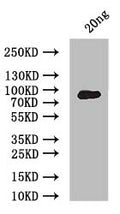 Western Blot
Positive WB detected in: recombinant protein
All lanes: ERVK-5 Antibody at 1:1000
Secondary
Goat polyclonal to rabbit IgG at 1/50000 dilution
Predicted band size: 90 kDa
Observed band size: 90 kDa