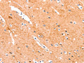 The image on the left is immunohistochemistry of paraffin-embedded Human brain tissue using CSB-PA862774(ANKZF1 Antibody) at dilution 1/35, on the right is treated with synthetic peptide. (Original magnification: ×200)