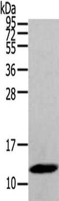 Gel: 8%SDS-PAGE,Lysate: 40 ug,,Primary antibody: CSB-PA862790(DEFB112 Antibody) at dilution 1/200 dilution,Secondary antibody: Goat anti rabbit IgG at 1/8000 dilution,Exposure time: 20 seconds