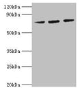 Western blot
All lanes: HSPA6 antibody at 2µg/ml
Lane 1: MCF-7 whole cell lysate
Lane 2: A431 whole cell lysate
Lane 3: Jurkat whole cell lysate
Secondary
Goat polyclonal to rabbit IgG at 1/10000 dilution
Predicted band size: 72 kDa
Observed band size: 72 kDa