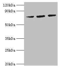 Western blot
All lanes: HSPA6 antibody at 2µg/ml
Lane 1: MCF-7 whole cell lysate
Lane 2: A431 whole cell lysate
Lane 3: Jurkat whole cell lysate
Secondary
Goat polyclonal to rabbit IgG at 1/10000 dilution
Predicted band size: 72 kDa
Observed band size: 72 kDa