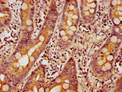 IHC image of CSB-PA863104LA01HU diluted at 1:500 and staining in paraffin-embedded human small intestine tissue performed on a Leica BondTM system. After dewaxing and hydration, antigen retrieval was mediated by high pressure in a citrate buffer (pH 6.0). Section was blocked with 10% normal goat serum 30min at RT. Then primary antibody (1% BSA) was incubated at 4&deg;C overnight. The primary is detected by a biotinylated secondary antibody and visualized using an HRP conjugated SP system.