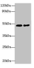 Western blot
All lanes: AARSD1 antibody at 0.8µg/ml
Lane 1: Hela whole cell lysate
Lane 2: U251 whole cell lysate
Secondary
Goat polyclonal to rabbit IgG at 1/10000 dilution
Predicted band size: 46, 59, 66 kDa
Observed band size: 46 kDa