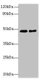 Western blot
All lanes: AARSD1 antibody at 0.8µg/ml
Lane 1: Hela whole cell lysate
Lane 2: U251 whole cell lysate
Secondary
Goat polyclonal to rabbit IgG at 1/10000 dilution
Predicted band size: 46, 59, 66 kDa
Observed band size: 46 kDa