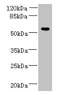 Western blot
All lanes: ADAT1 antibody at 6µg/ml + MDA-MB-231 whole cell lysate
Secondary
Goat polyclonal to rabbit IgG at 1/10000 dilution
Predicted band size: 56, 39 kDa
Observed band size: 56 kDa