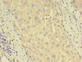 Immunohistochemistry of paraffin-embedded human liver tissue using CSB-PA863128LA01HU at dilution of 1:100
