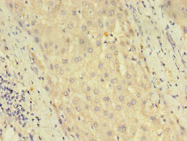 Immunohistochemistry of paraffin-embedded human liver tissue using CSB-PA863128LA01HU at dilution of 1:100