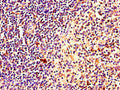 Immunohistochemistry of paraffin-embedded human spleen tissue using CSB-PA863144LA01HU at dilution of 1:100