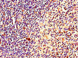 Immunohistochemistry of paraffin-embedded human spleen tissue using CSB-PA863144LA01HU at dilution of 1:100