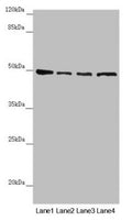 Western blot All lanes: AP1M1 antibody at 1.43µg/ml Lane 1: A375 whole cell lysate Lane 2: Jurkat whole cell lysate Lane 3: Hela whole cell lysate Lane 4: HepG2 whole cell lysate Secondary Goat polyclonal to rabbit IgG at 1/10000 dilution Predicted band size: 49, 50 kDa Observed band size: 49 kDa